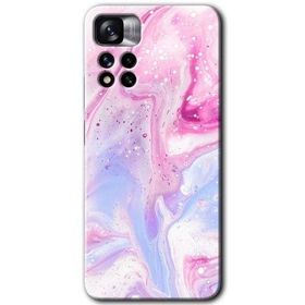Xiaomi Redmi Note 11 Pro Plus 5G Kabarmış Leke Baskılı Uyumlu Silikon Kılıf