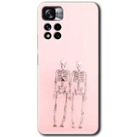 Xiaomi Redmi Note 11 Pro Plus 5G Yaşayan Çift Baskılı Uyumlu Silikon Kılıf