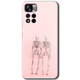 Xiaomi Redmi Note 11 Pro Plus 5G Yaşayan Çift Baskılı Uyumlu Silikon Kılıf
