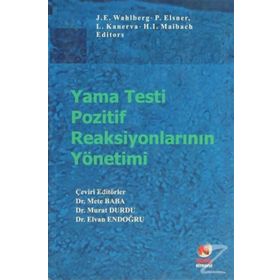 YAMA TESTI POZITIF REAKSİYONLARININ YÖNETİMİ - METE BABA