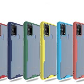 Zore Galaxy M31 Parfe Kapak Kılıf