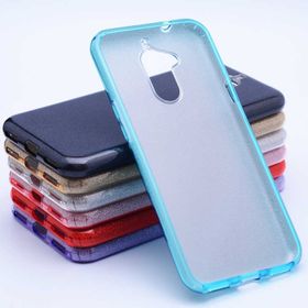 Zore General Mobile 8 Shining Silikon Kılıf