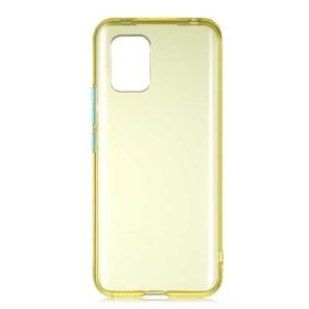 Zore Xiaomi Mi 10 Lite Bistro Kapak Kılıf