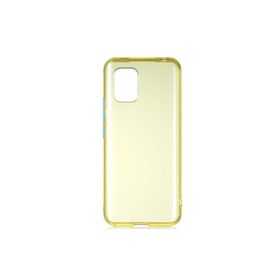 Zore Xiaomi Mi 10 Lite Bistro Kapak Kılıf