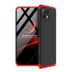 Zore Xiaomi Mi 11 Lite Ays Kapak Kılıf