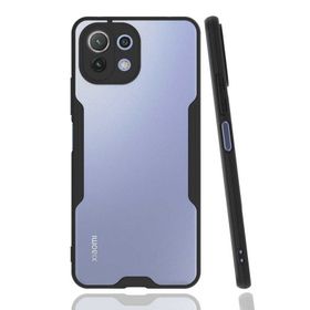 Zore Xiaomi Mi 11 Lite Parfe Kapak Kılıf