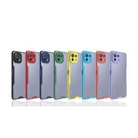 Zore Xiaomi Mi 11 Lite Parfe Kapak Kılıf