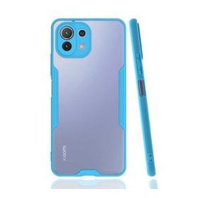 Zore Xiaomi Mi 11 Lite Parfe Kapak Kılıf