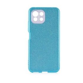 Zore Xiaomi Mi 11 Lite Shining Silikon Cep Telefonu Kılıfı