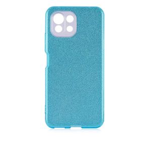 Zore Xiaomi Mi 11 Lite Shining Silikon Cep Telefonu Kılıfı