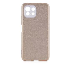 Zore Xiaomi Mi 11 Lite Shining Silikon Cep Telefonu Kılıfı
