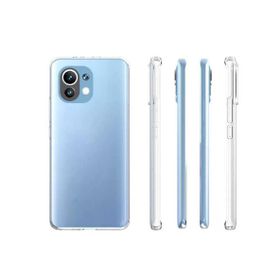 Zore Xiaomi Mi 11 Lite Süper Silikon Kapak Şeffaf Kılıf