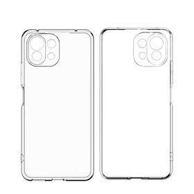 Zore Xiaomi Mi 11 Zore Kamera Korumalı Süper Silikon Cep Telefonu Kılıfı