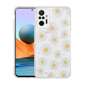 Zore Xiaomi Redmi Note 10 Pro Simli Desenli Kamera Korumalı Parlak Popy Kapak Kılıf