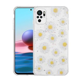 Zore Xiaomi Redmi Note 10S Simli Desenli Kamera Korumalı Parlak Popy Kapak Kılıf