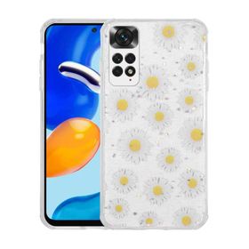 Zore Xiaomi Redmi Note 11 Global Simli Desenli Kamera Korumalı Parlak Popy Kapak Kılıf