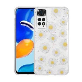 Zore Xiaomi Redmi Note 11 Global Simli Desenli Kamera Korumalı Parlak Popy Kapak Kılıf