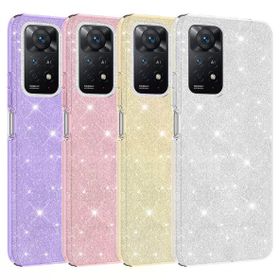Zore Xiaomi Redmi Note 11 Pro 5G Parıltılı Simli Shining Silikon Cep Telefonu Kılıfı