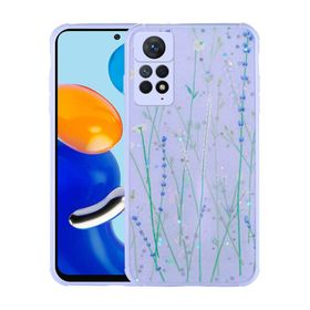 Zore Xiaomi Redmi Note 11 Pro 5G Simli Desenli Kamera Korumalı Parlak Popy Kılıf