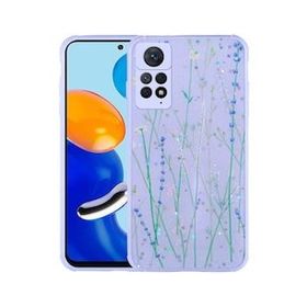 Zore Xiaomi Redmi Note 11 Pro 5G Simli Desenli Kamera Korumalı Parlak Popy Kılıf
