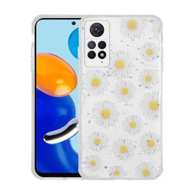 Zore Xiaomi Redmi Note 11 Pro 5G Simli Desenli Kamera Korumalı Parlak Popy Kılıf