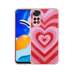 Zore Xiaomi Redmi Note 11S Global Simli Desenli Kamera Korumalı Parlak Popy Kapak Kılıf