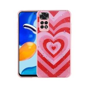 Zore Xiaomi Redmi Note 11S Global Simli Desenli Kamera Korumalı Parlak Popy Kılıf