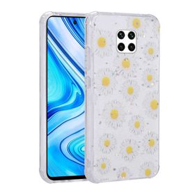 Zore Xiaomi Redmi Note 9S Simli Desenli Kamera Korumalı Parlak Popy Kapak Kılıf