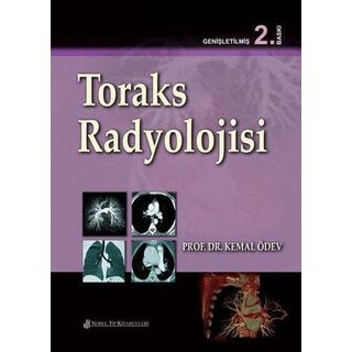 Toraks Radyolojisi - Nobel Tıp Kitabevi