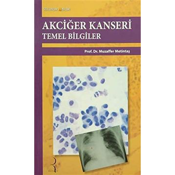 Akciğer Kanseri Temel Bilgiler - Muzaffer Metintaş