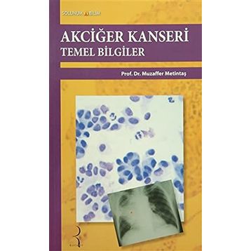 Akciğer Kanseri Temel Bilgiler - Muzaffer Metintaş