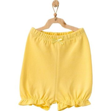 Andy Wawa AC21633R Ananas Desenli Alt Üst Sarı Şort Kız Bebek Takım