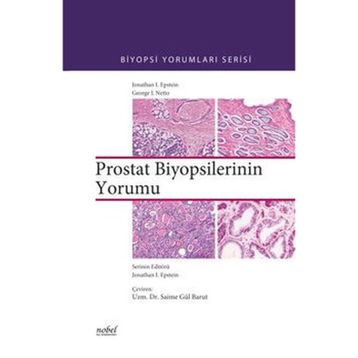 Biyopsilerin Yorumu Prostat - Nobel Tıp Kitabevleri