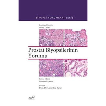 Biyopsilerin Yorumu Prostat - Nobel Tıp Kitabevleri