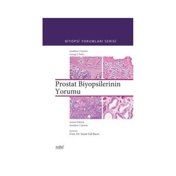 Biyopsilerin Yorumu Prostat - Nobel Tıp Kitabevleri
