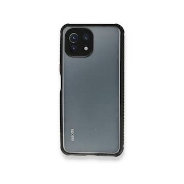 BSSM Miami Şeffaf Silikon - Siyah Xiaomi Mİ 11 Lite Kılıf
