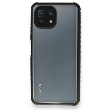 BSSM Miami Şeffaf Silikon - Siyah Xiaomi Mİ 11 Lite Kılıf