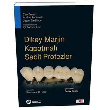 Dikey Marjin Kapatmalı Sabit Protezler - Güneş Tıp Kitabevi