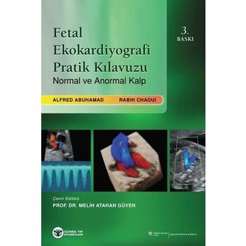 Ekokardiyografi