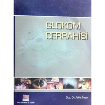 Glokom Cerrahisi - Atilla Bayer