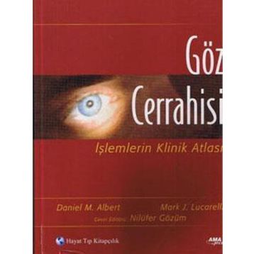 Göz Cerrahisi - Daniel M. Albert Mark J. Lucarelli