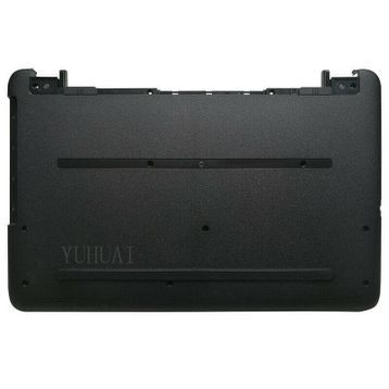 Hp 15-BA007NT Silver Üst Kasa
