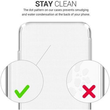 Kvy Xiaomi Mİ 11 Ultra Kamera Korumalı Süper Silikon Şeffaf Kılıf
