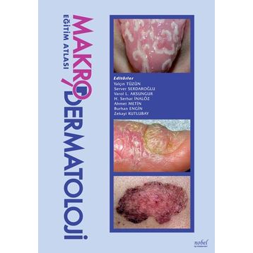 Makro Dermatoloji Eğitim Atlası - Nobel Tıp Kitabevleri