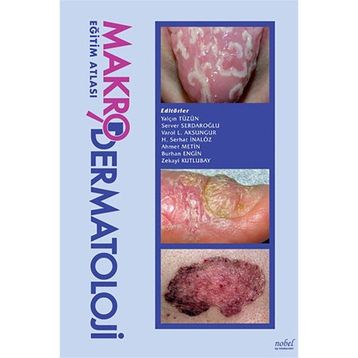 Makro Dermatoloji Eğitim Atlası - Nobel Tıp Kitabevleri