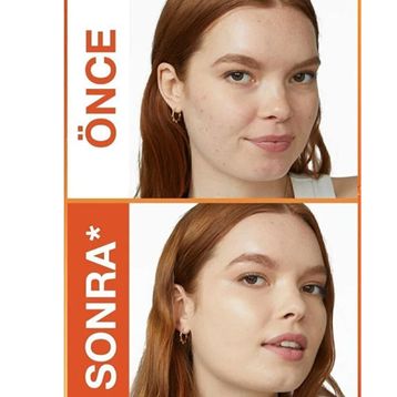 Maybelline No: 30 Super Stay Skin Tint Up To 24H +Vitamin C 30 ml Foundation