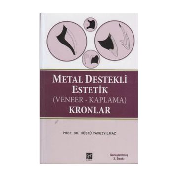 METAL DESTEKLI ESTETIK (VENEER - KAPLAMA) KRONLAR - HÜSNÜ YAVUZYILMAZ