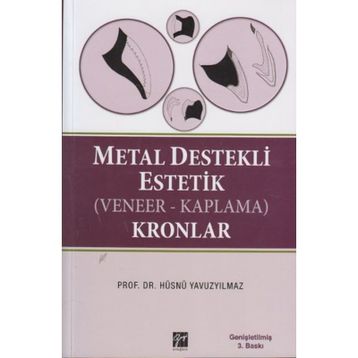 METAL DESTEKLI ESTETIK (VENEER - KAPLAMA) KRONLAR - HÜSNÜ YAVUZYILMAZ