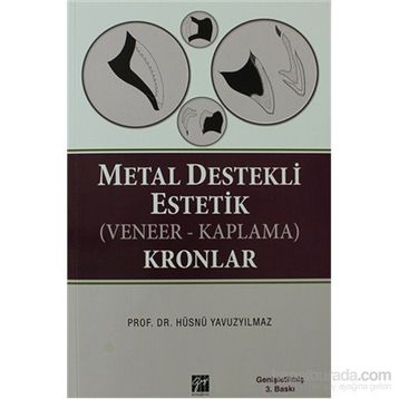 METAL DESTEKLI ESTETIK (VENEER - KAPLAMA) KRONLAR - HÜSNÜ YAVUZYILMAZ