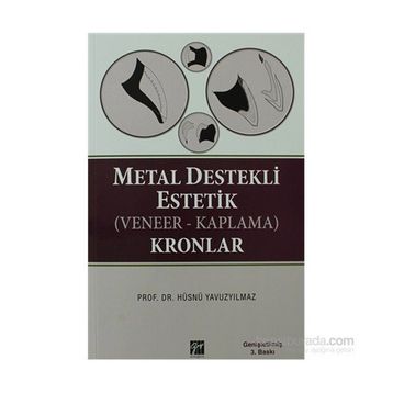 METAL DESTEKLI ESTETIK (VENEER - KAPLAMA) KRONLAR - HÜSNÜ YAVUZYILMAZ